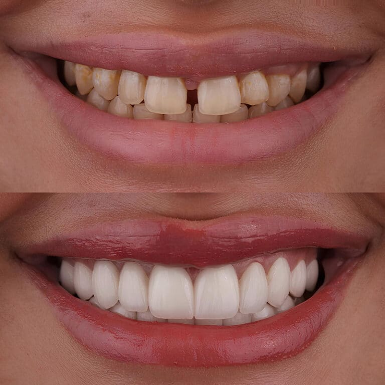Cosmetic Dentistry